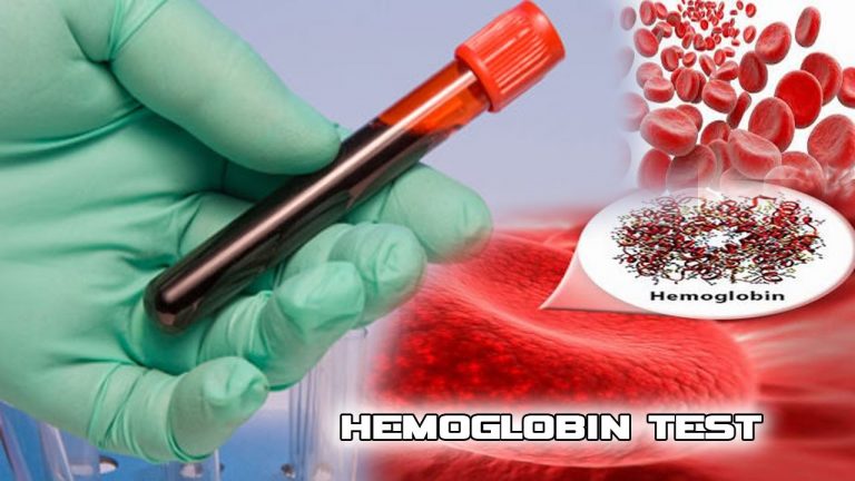 Nuga.co Ini Yang Menyebabkan Hemoglobin Rendah